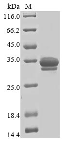 SDS-PAGE