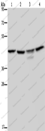 Вестерн-блоттинг, CSNK2A1, клетки K562, 293T, Jurkat и ткань мозга мыши