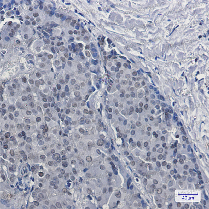 Валидация AntibodySystem RHB02001