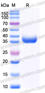 EHJ96301, SDS-PAGE