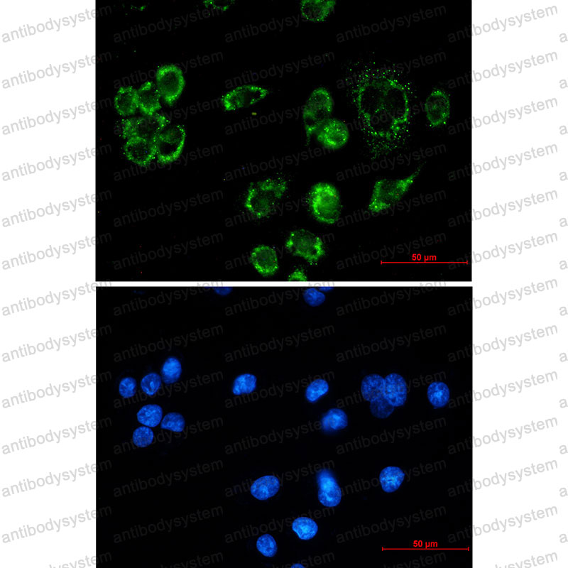Валидация IF - AntibodySystem RHJ87301