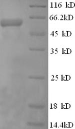SDS-PAGE