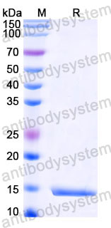 Валидация SDS-PAGE - AntibodySystem RVV00803