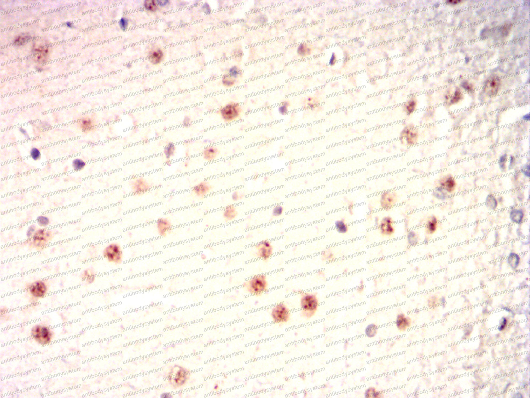 Валидация AntibodySystem RHF42903 (2513)