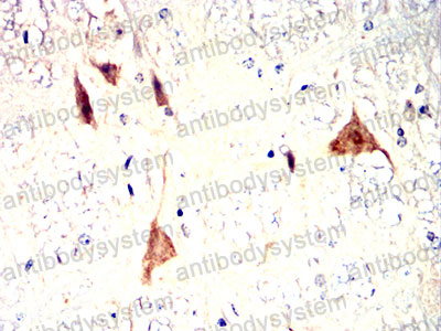 Валидация AntibodySystem RHJ53201 (3457)