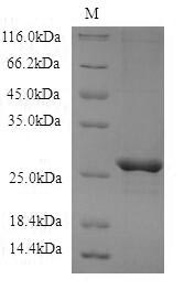SDS-PAGE