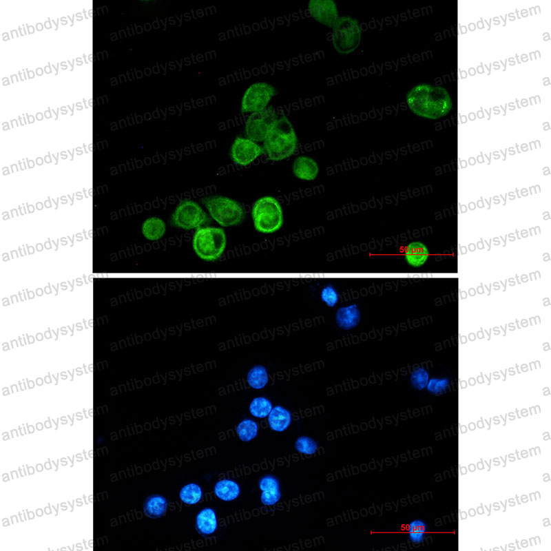 Валидация IF - AntibodySystem RHE47901