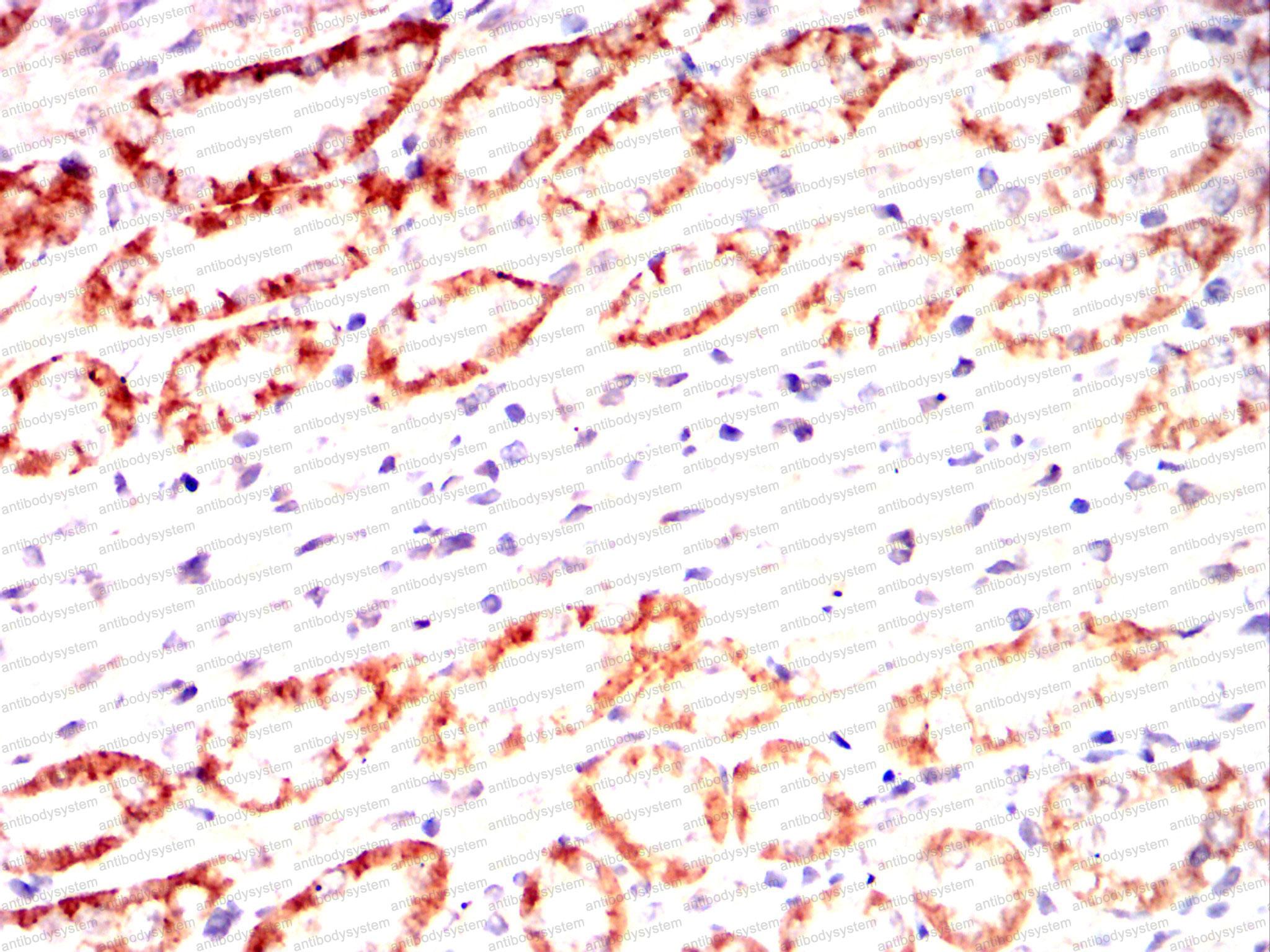 Валидация AntibodySystem RHC15302