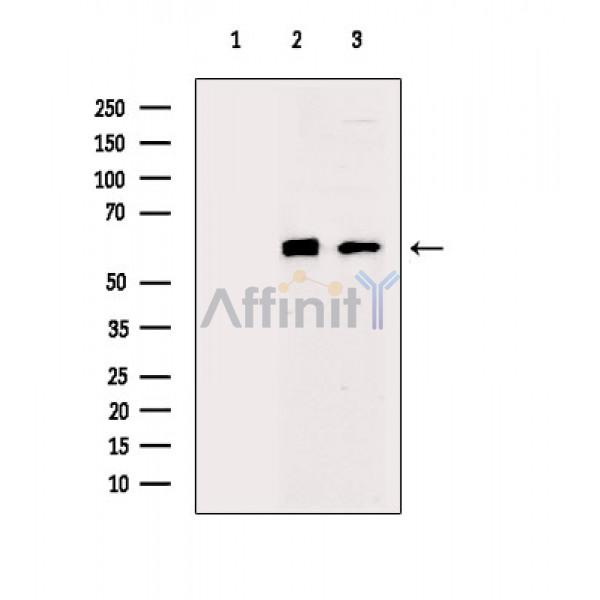 Валидация Affinity AF6102 - 3308