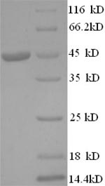 SDS-PAGE