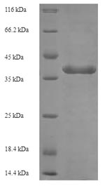 SDS-PAGE