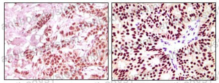 Валидация AntibodySystem RHC03204