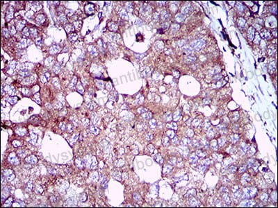 Валидация AntibodySystem RHB86915