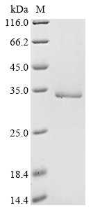 SDS-PAGE