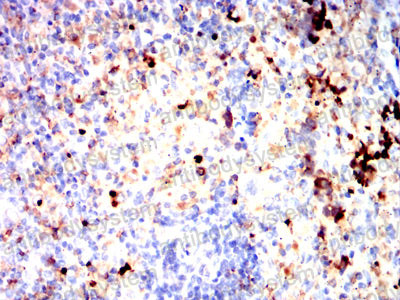 Валидация AntibodySystem RHD71003 (1752)