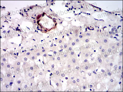 Валидация AntibodySystem RHE39703 (2146)