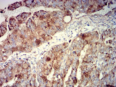 Валидация AntibodySystem RHC37602 (984)