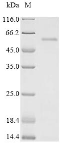 SDS-PAGE