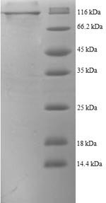 SDS-PAGE