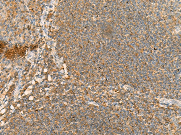 Иммуногистохимия, CD48, ткань миндалин человека