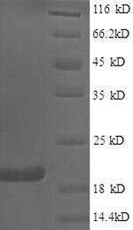 SDS-PAGE