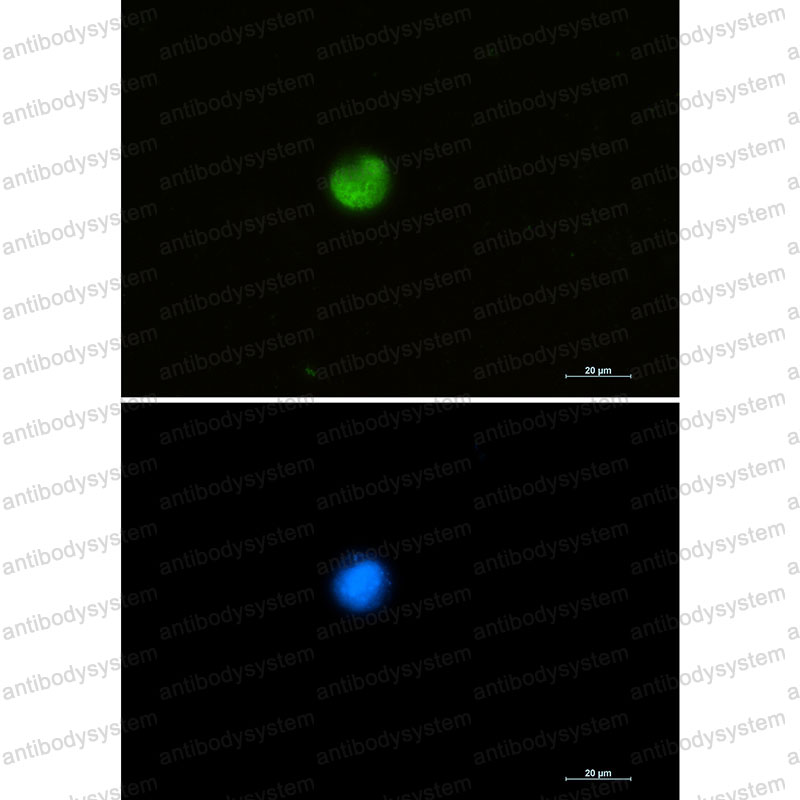 Валидация IF - AntibodySystem RHE91301