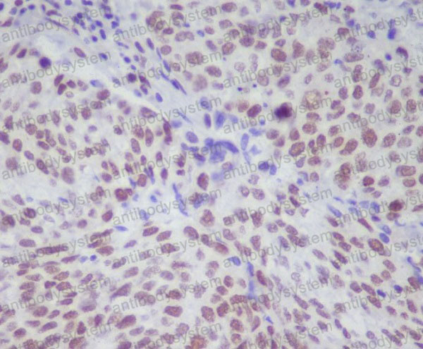 Валидация AntibodySystem RHE34302