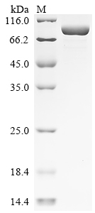 SDS-PAGE