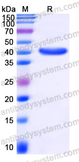 YHJ34902, SDS-PAGE
