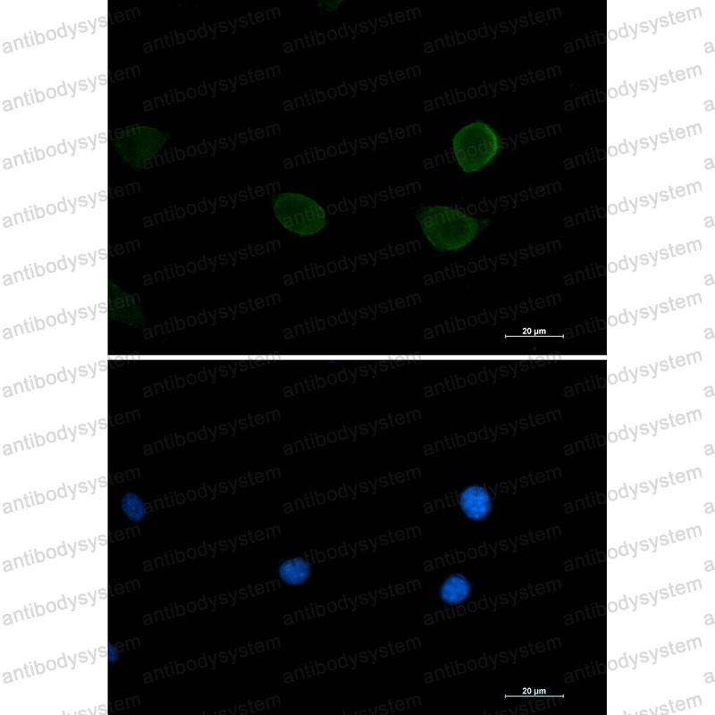 Валидация IF - AntibodySystem RHJ73501