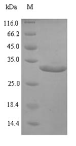 SDS-PAGE
