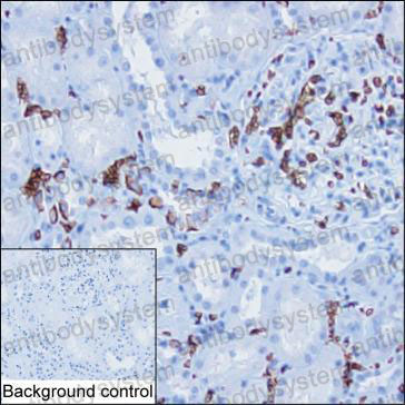 Валидация AntibodySystem RHB99803