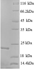 SDS-PAGE