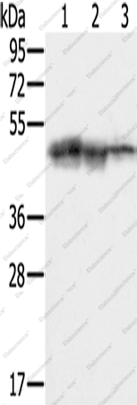 Вестерн-блоттинг, SMARCB1, клетки HepG2, K562 и Jurkat
