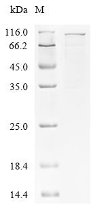 SDS-PAGE