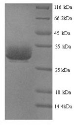 SDS-PAGE