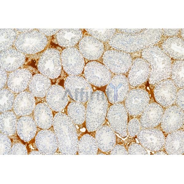 Валидация Affinity DF12029 - 6056