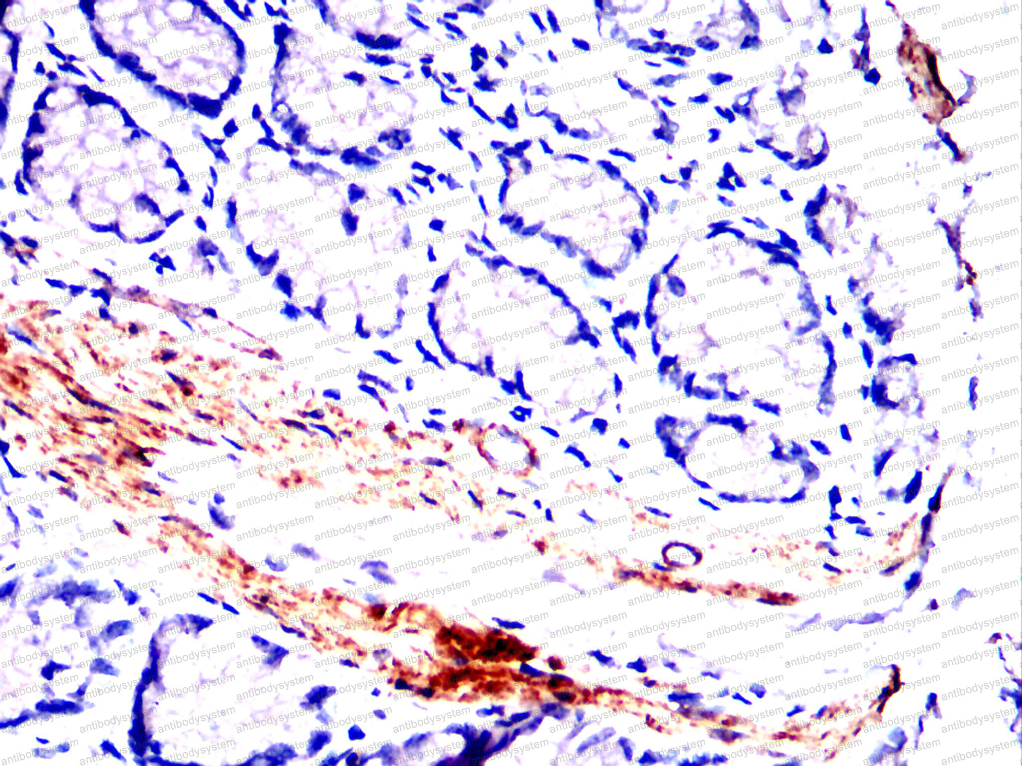 Валидация AntibodySystem RHF52709 (2552)