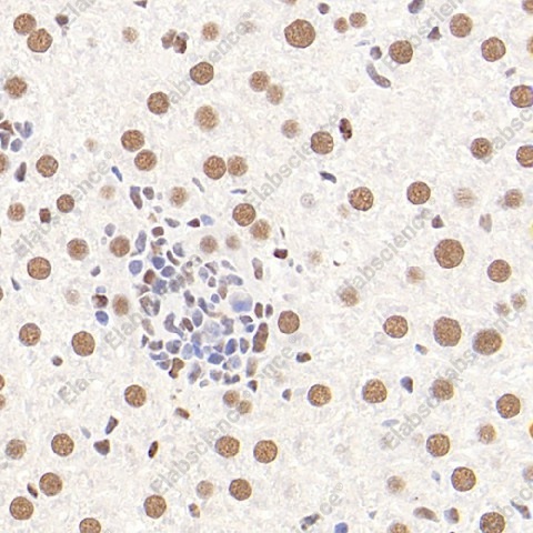 Иммуногистохимия, Glucocorticoid Receptor, ткань печени мыши