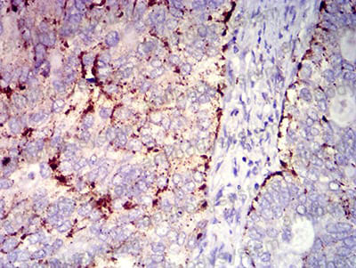 Валидация AntibodySystem RHD65005