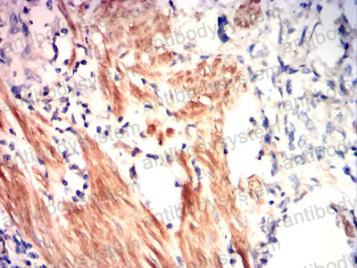 Валидация AntibodySystem RHF45102 (2517)