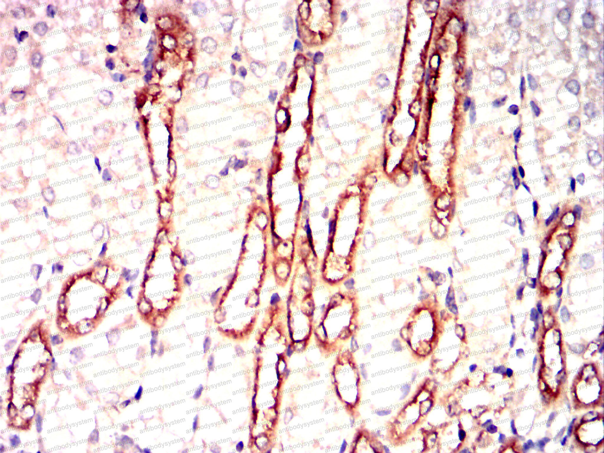 Валидация AntibodySystem RHD53604 (1634)