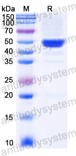 EHC33705, SDS-PAGE