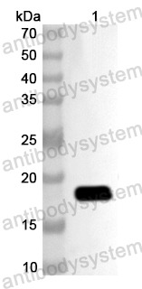 Валидация AntibodySystem PHB00601