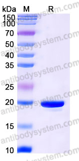 YHE03002, SDS-PAGE