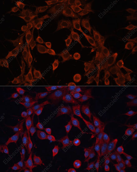 Иммунофлуоресценция, ABCA12, клетки NIH-3T3