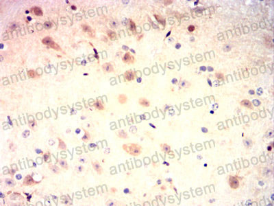 Валидация AntibodySystem RHB26401 (304)