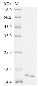 SDS-PAGE