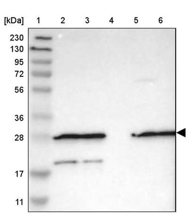 Валидация AssayVector ARM1387(1084)