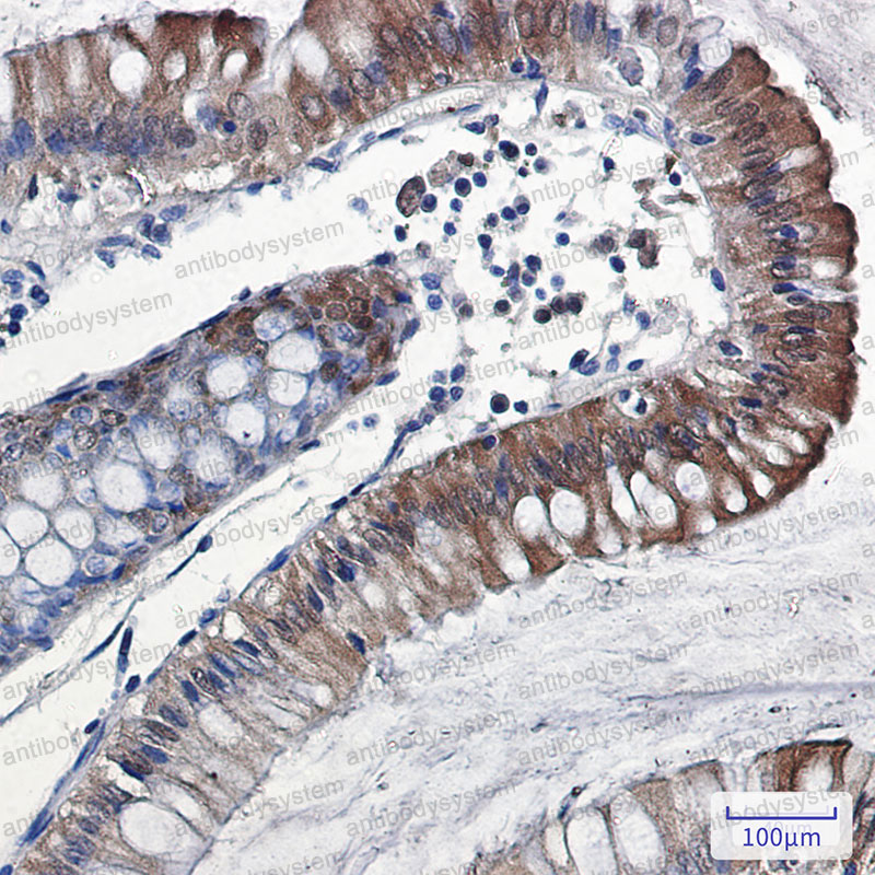 Валидация AntibodySystem RHG70701